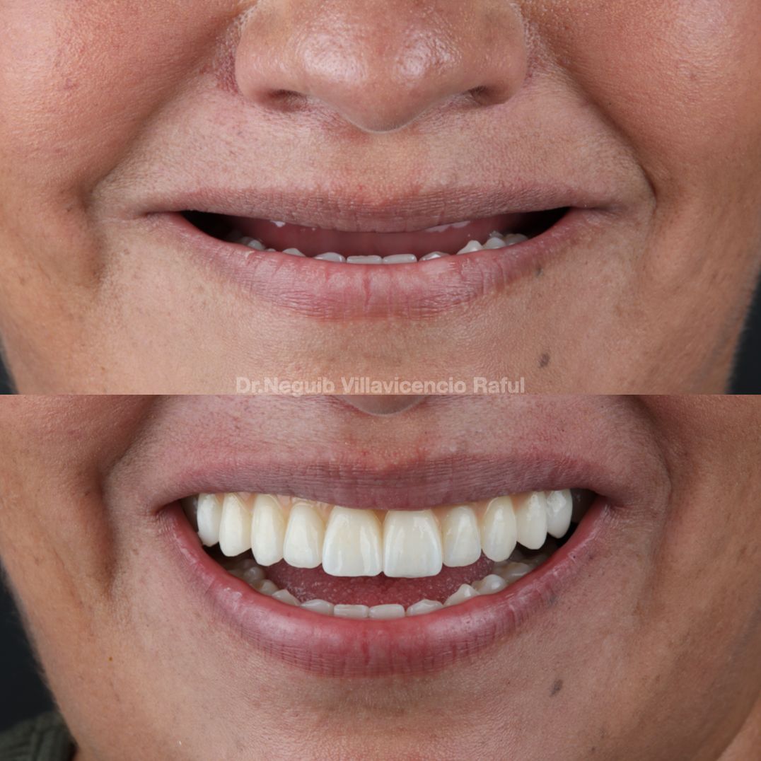 Neguib Villavicencio Raful-22