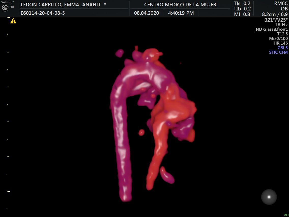 Julio Cesar Monárrez Martín-24
