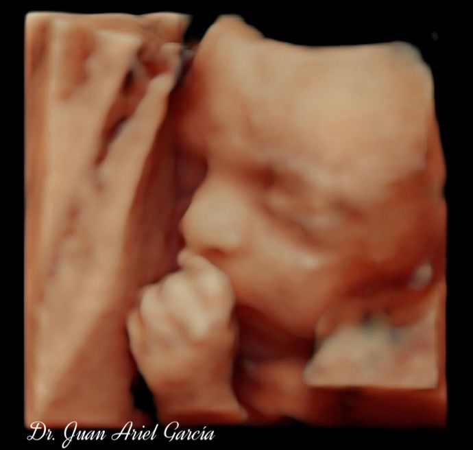 Juan Ariel Garcia Gonzalez-12