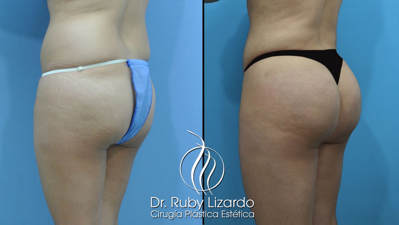 Ruby Lizardo Ramírez Robles-18