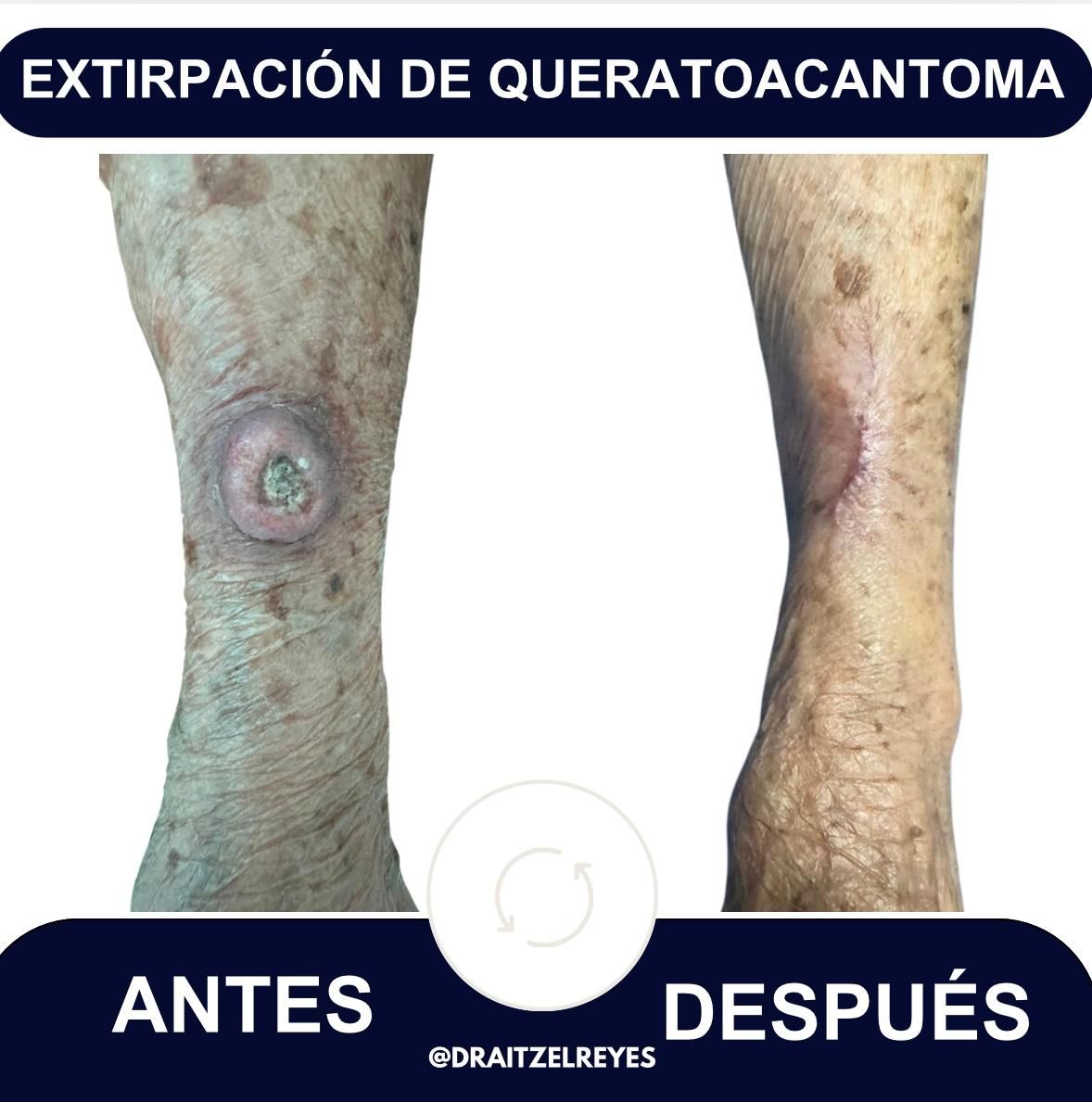 Itzel Anayn Flores Reyes-19