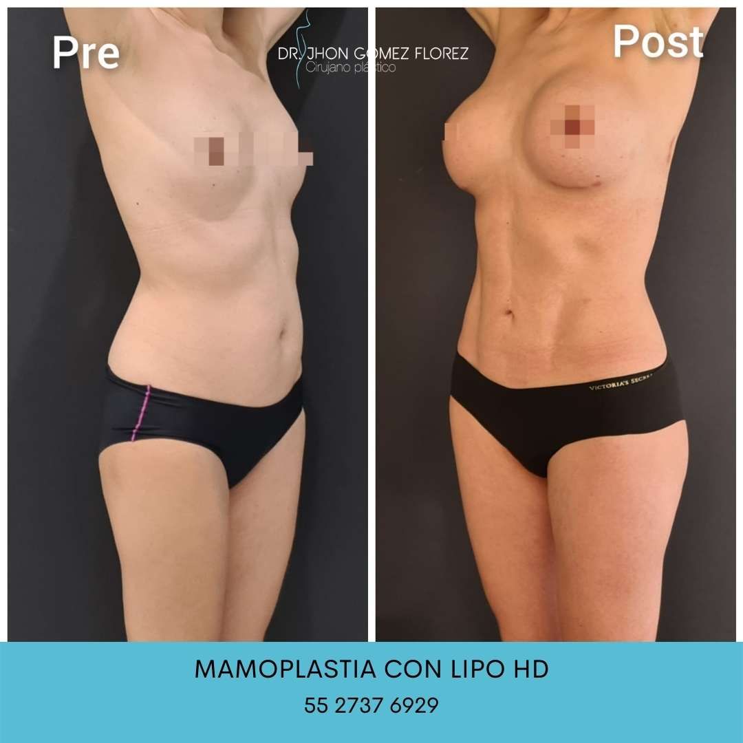 Jhon César Gómez Florez-6