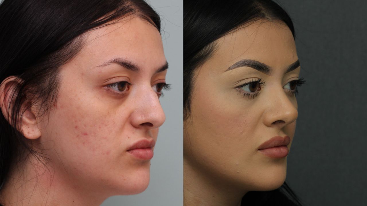 Angel Castro Urquizo-127