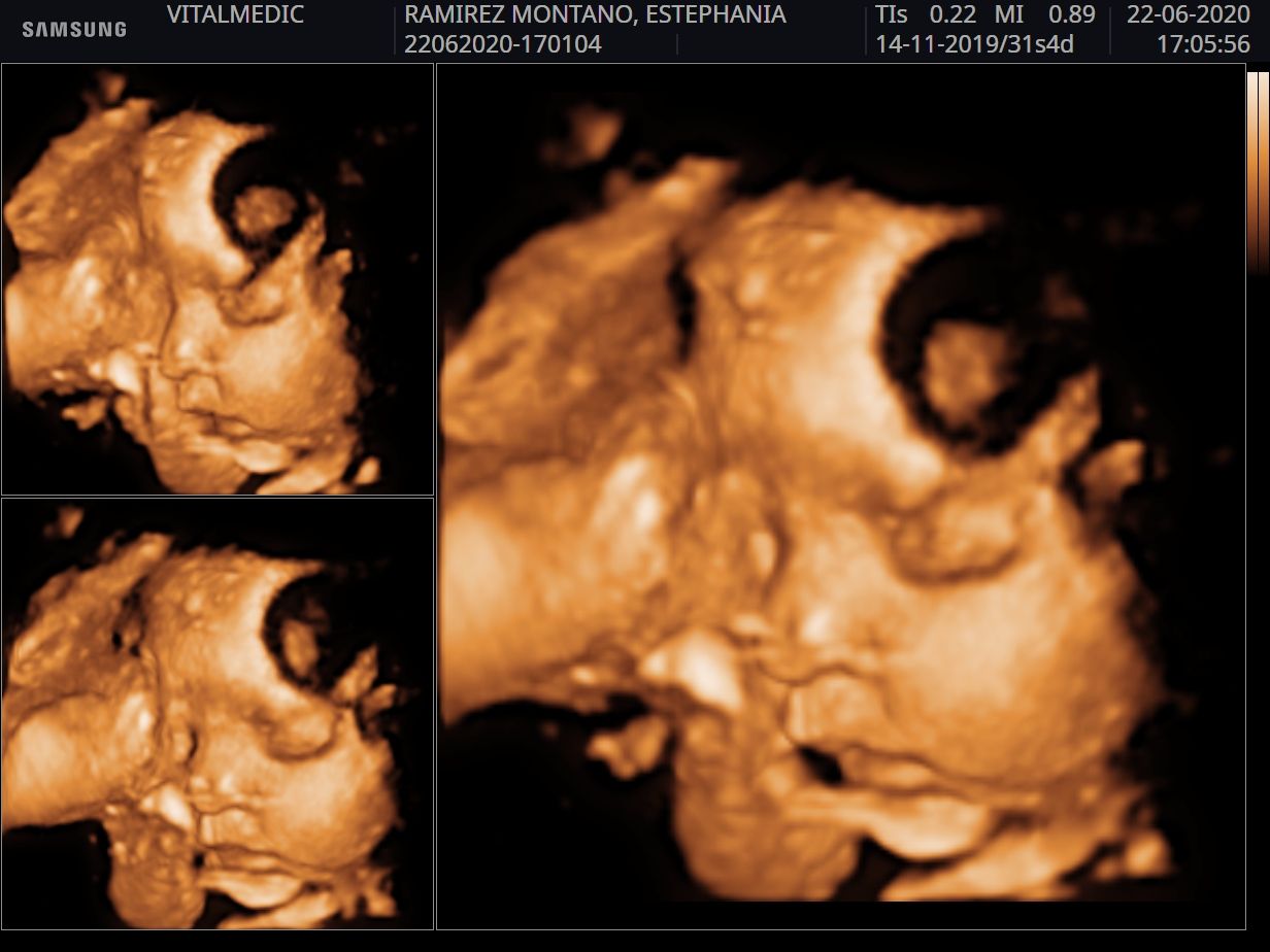 Monserrat Ramírez Penilla-1