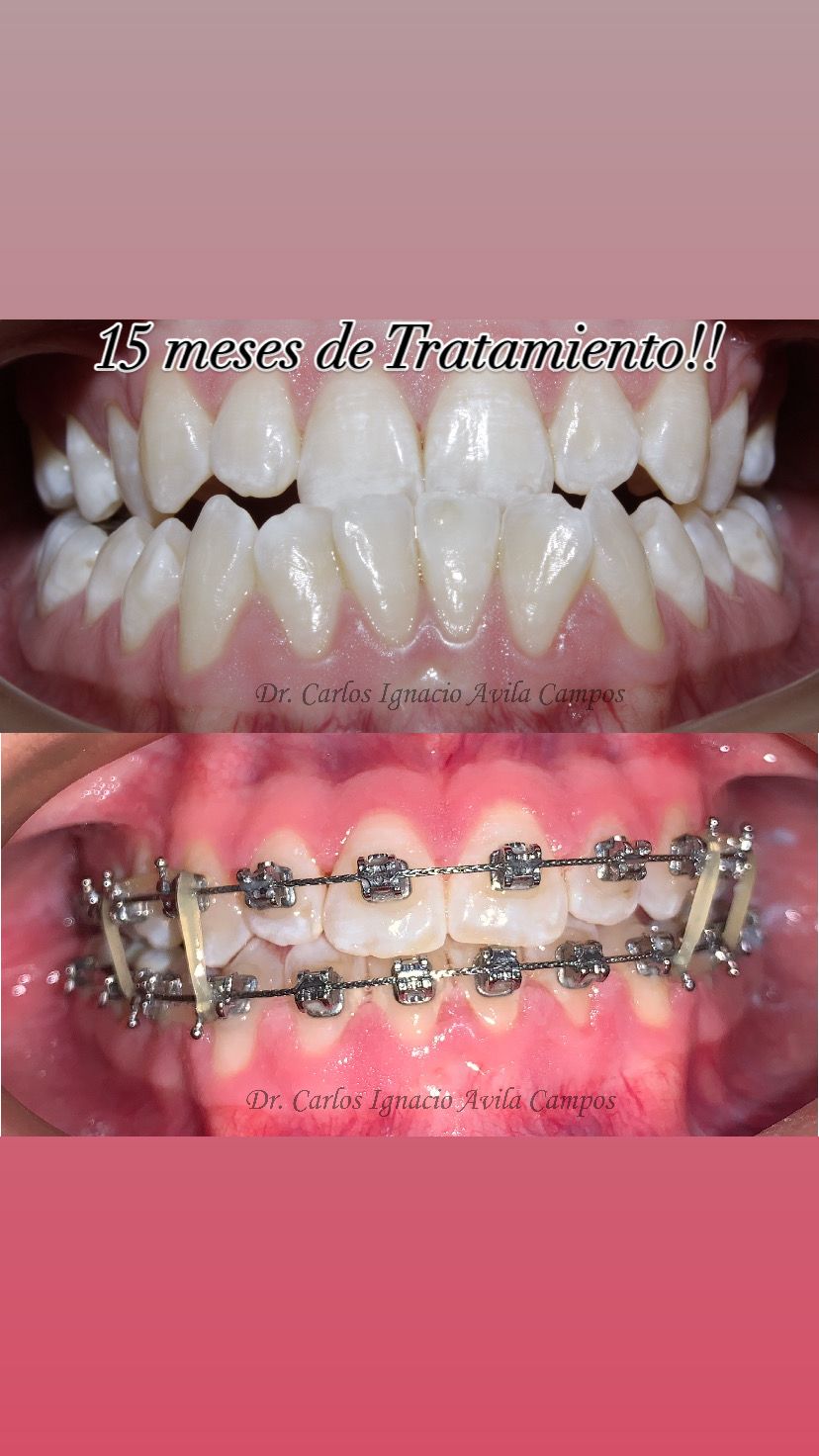 Carlos Ignacio Avila Campos-11