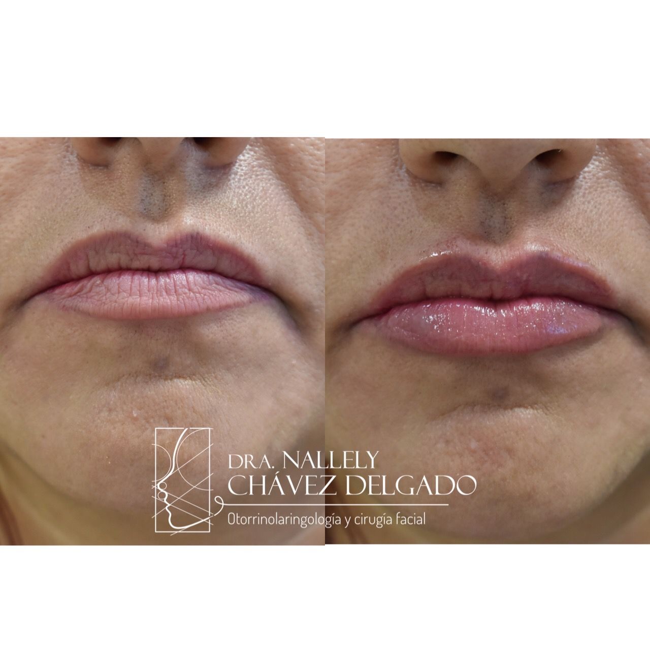 Nallely Chávez Delgado-15