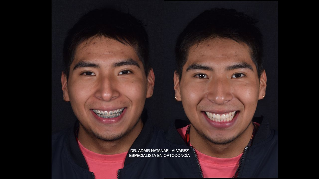 Adair Natanael Alvarez Castañeda-3