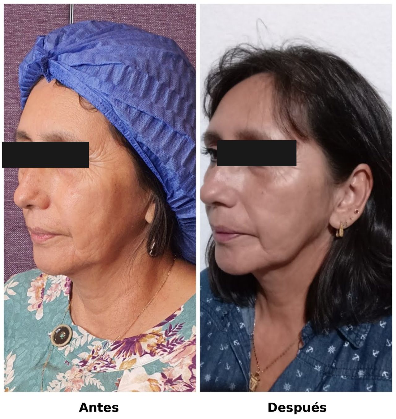 Miguel Rubio Henaine-23