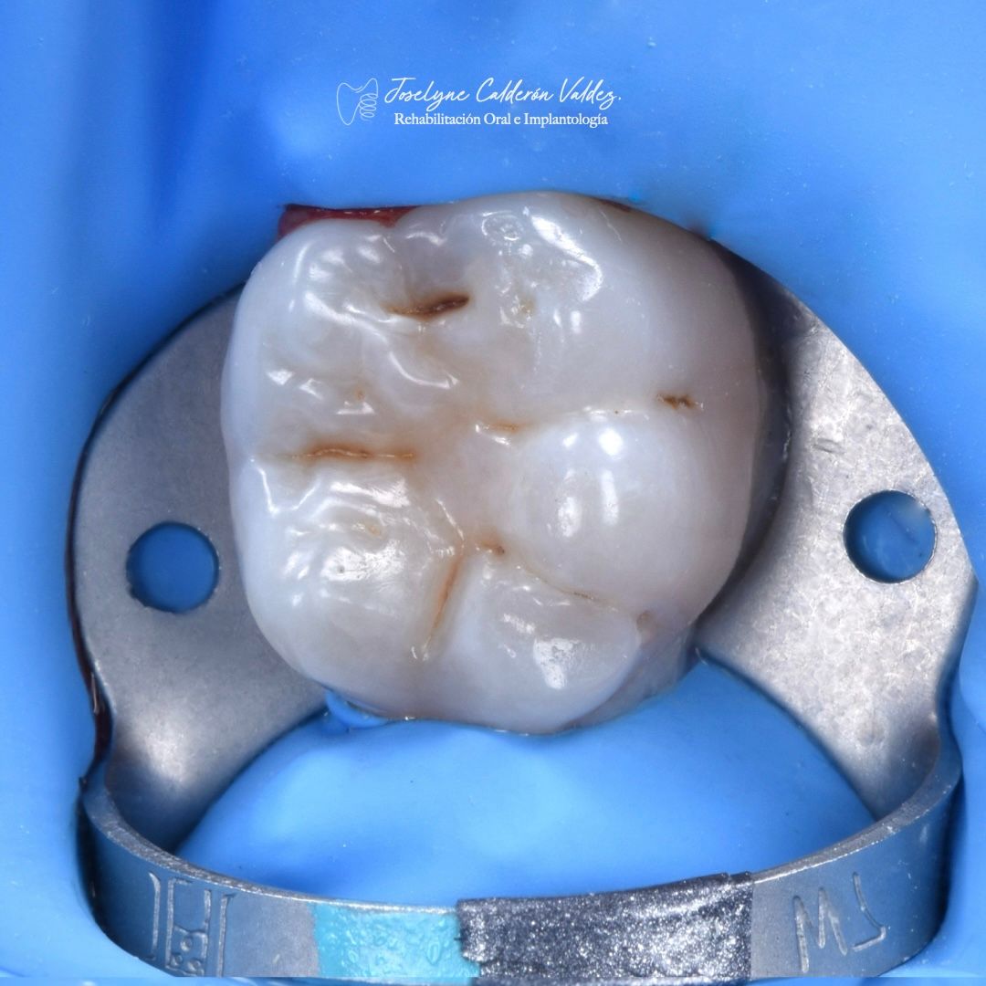 Joselyne Calderón Valdez-10