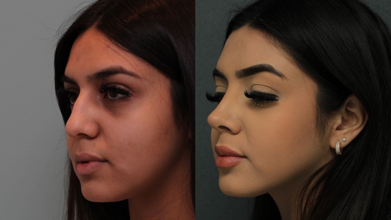 Angel Castro Urquizo-17