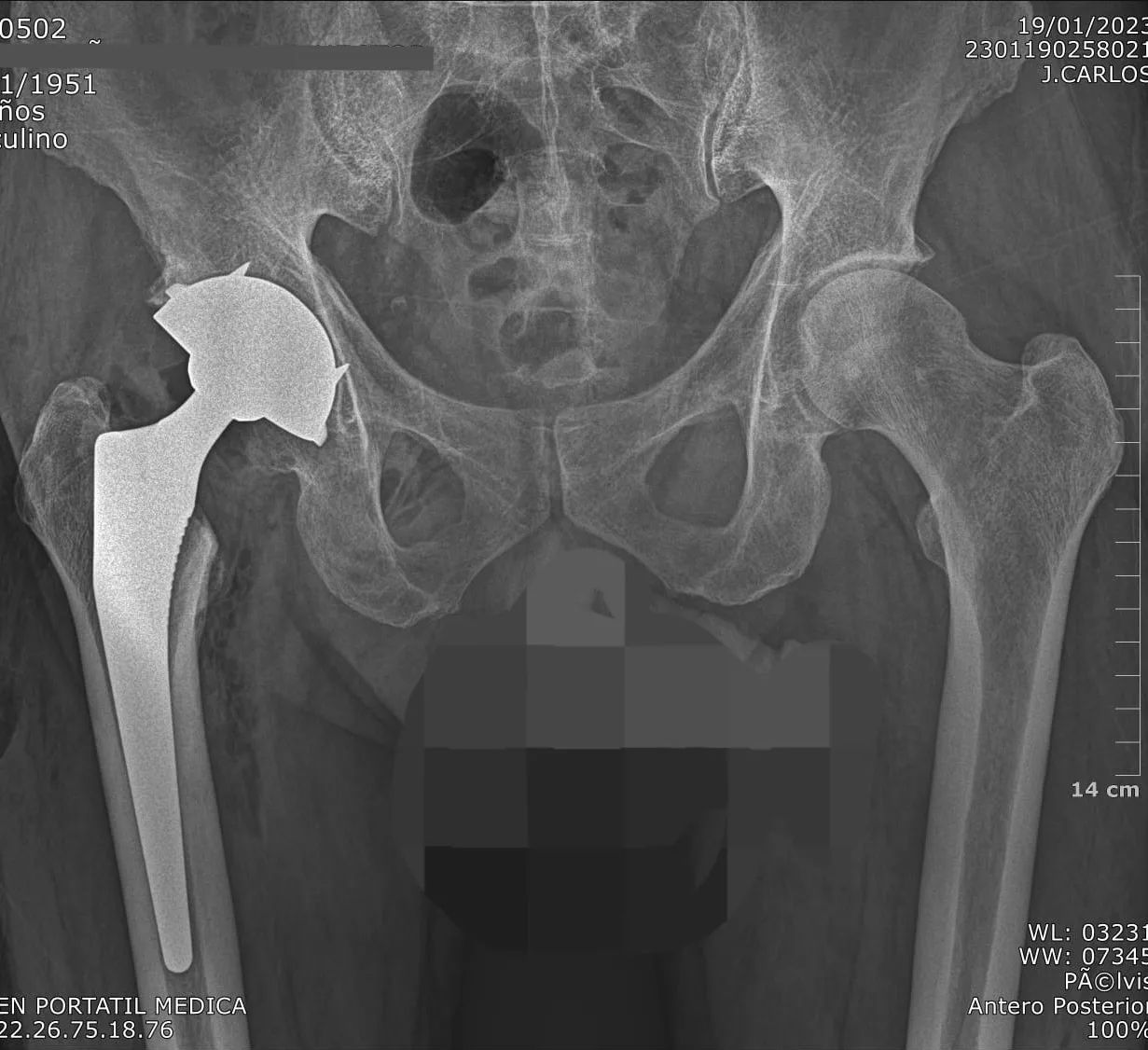 Alejandro Martínez Ramírez-14