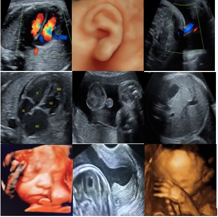 Merle Sánchez López-1