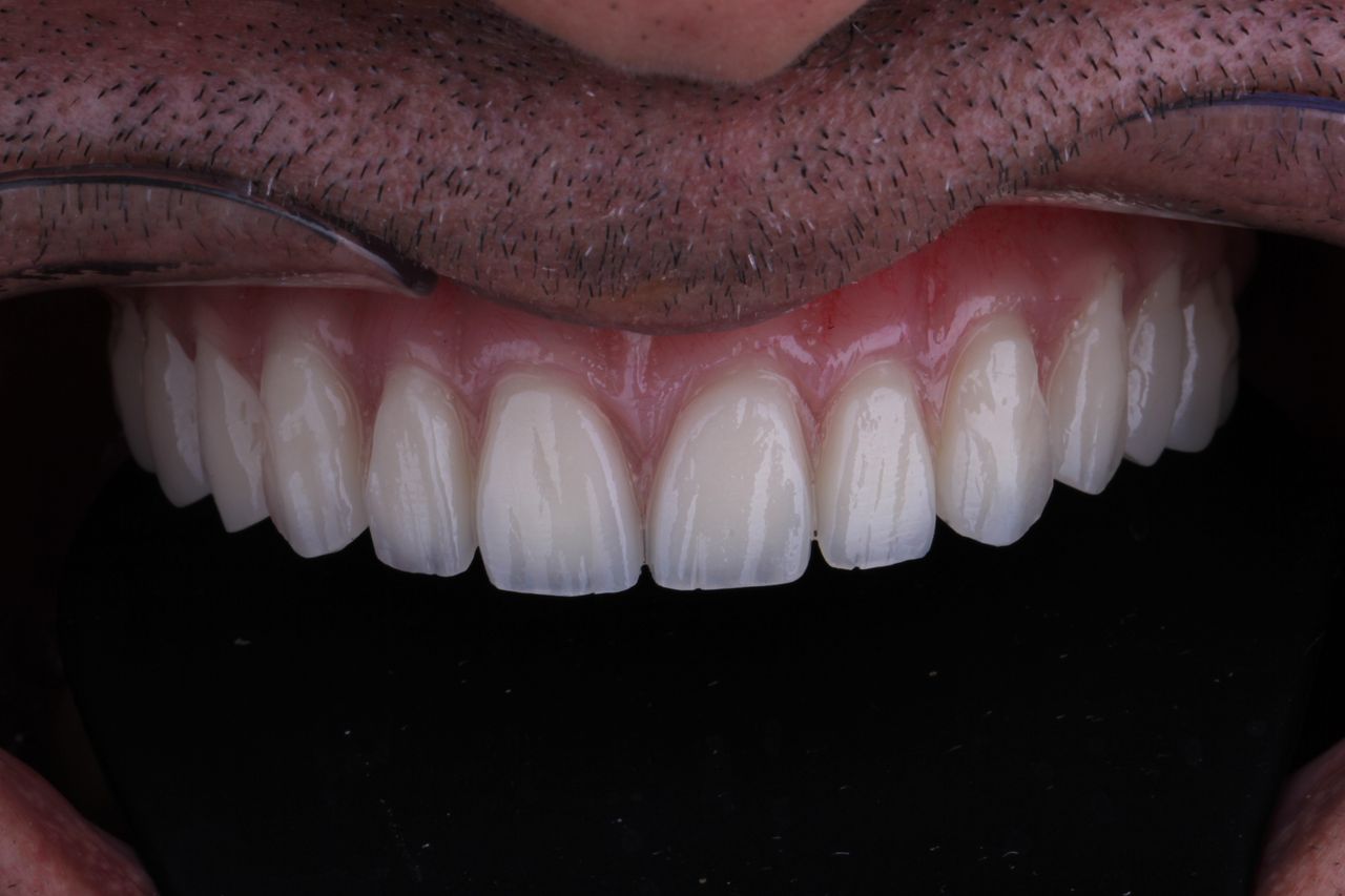 Josué Márquez Gómez-29