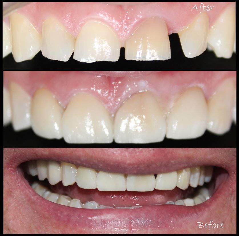 Aimee Valles Monárrez-24