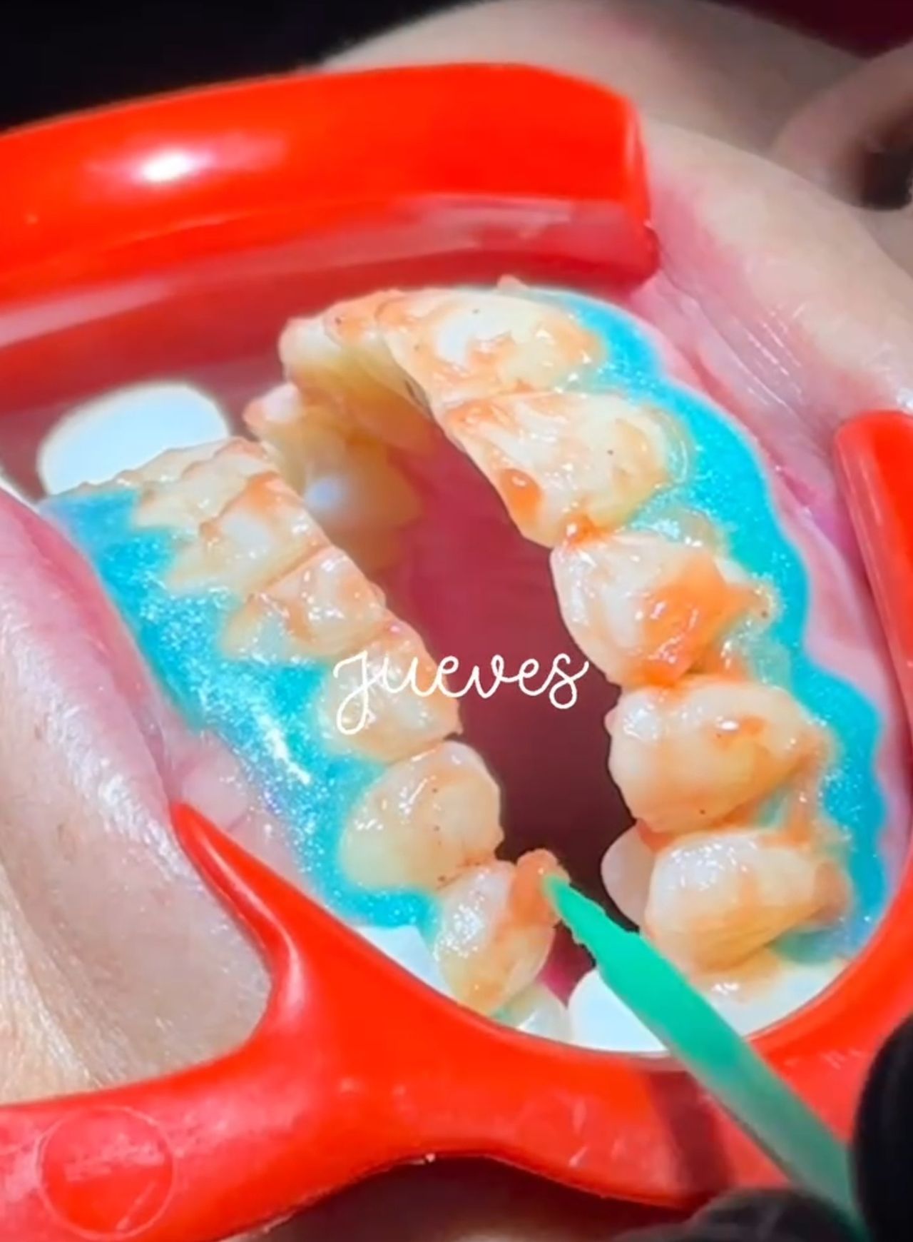 Leonardo Hernández Fernández-6