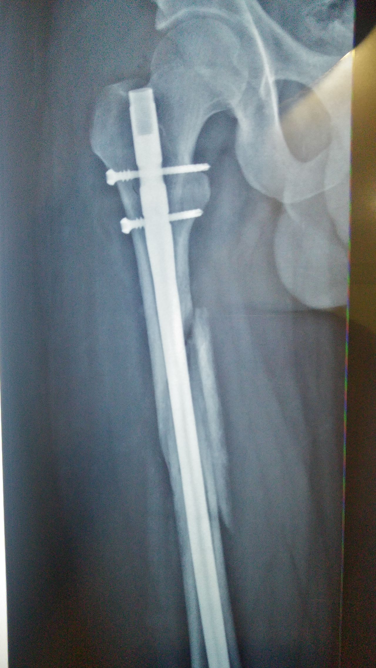 Rafael Antonio Ricárdez Balcázar-1