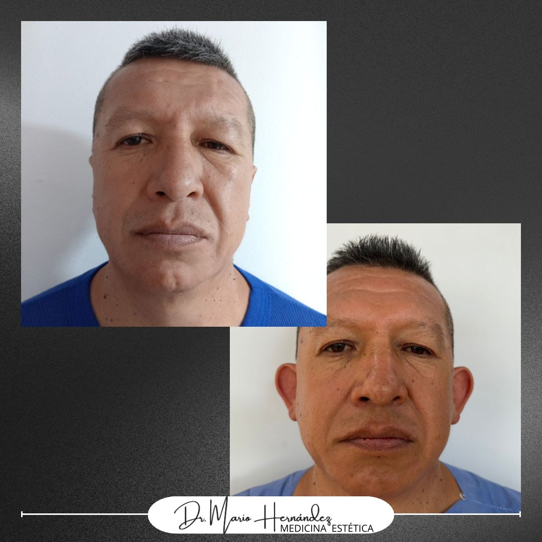 Mario Hernandez Luna-26