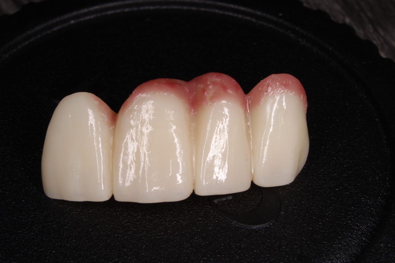 Andrés Tovar López-15