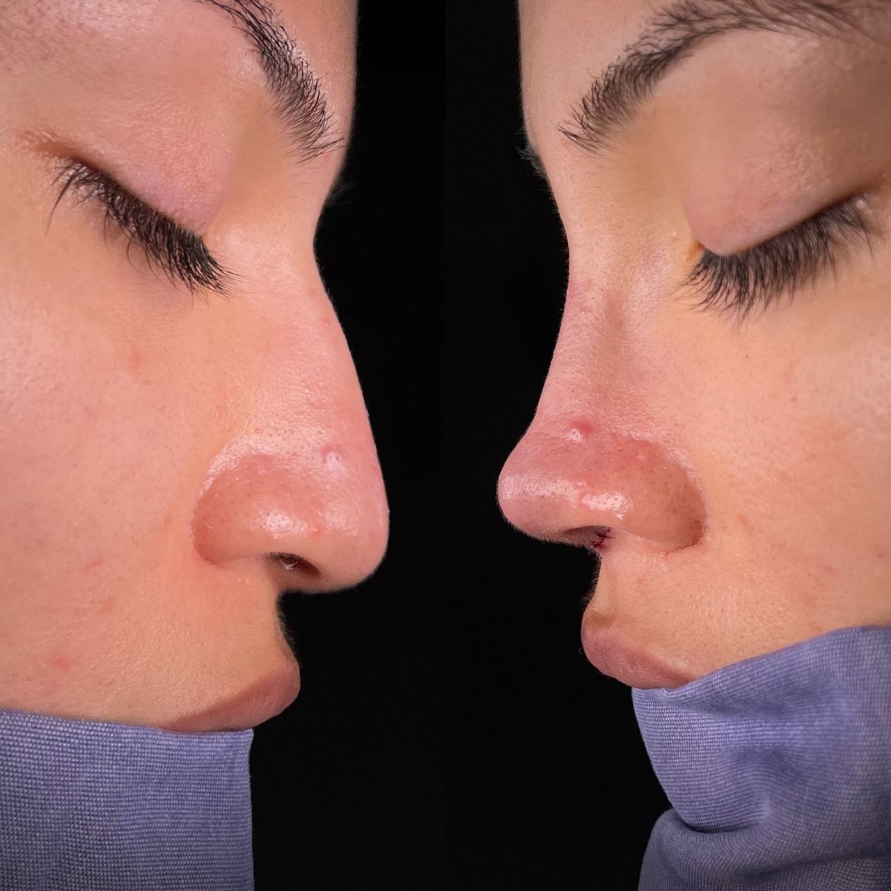 Angel Castro Urquizo-170