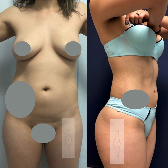 Rubén Nieto Balcázar-9