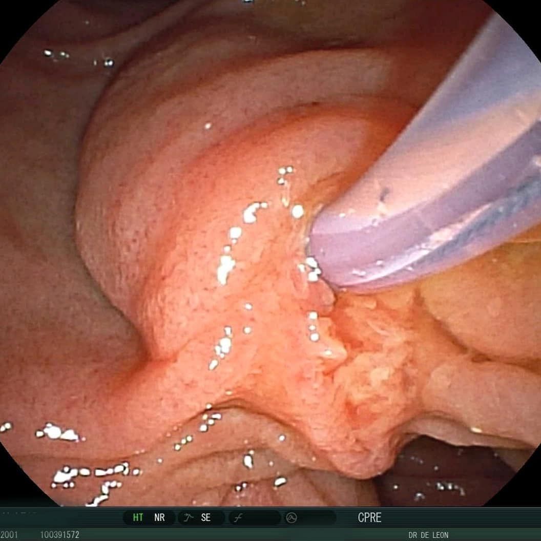 Edgar Alan De León Rojas-15