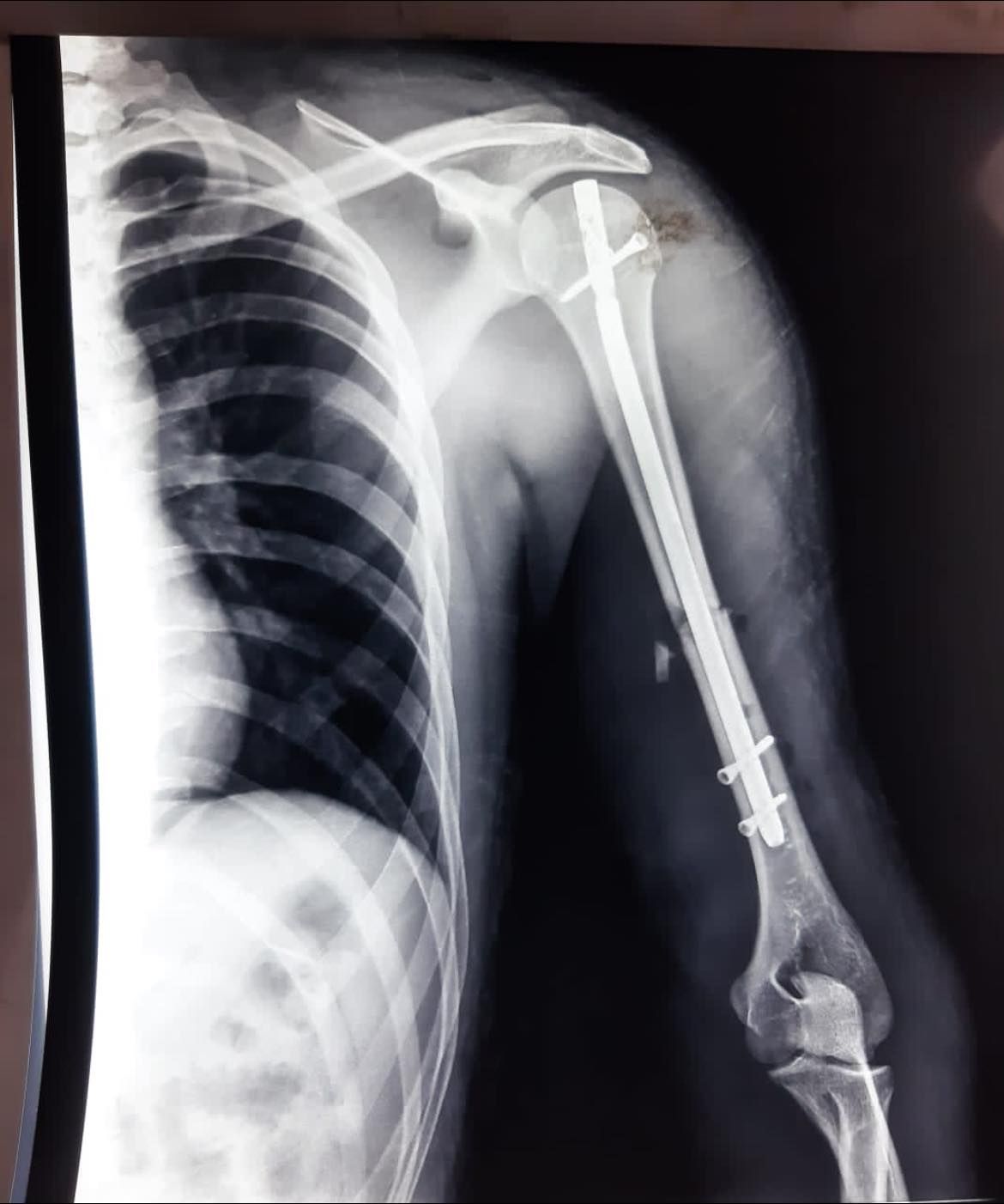 Felix Alfaro Arias-19