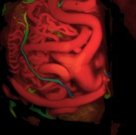 Alejandro Serrano Rubio-12