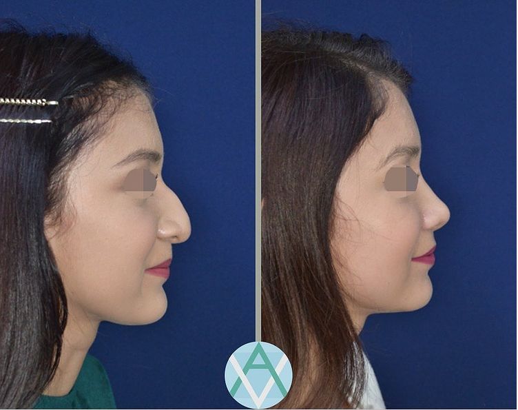 Alfonso Villaseñor Herrero-8