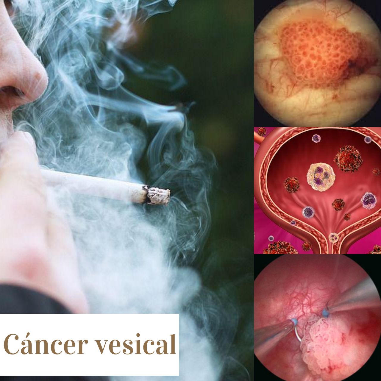 Eddy Gabriel Muñoz Lumbreras-11