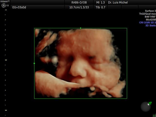 Luis Michel Fernandez-0