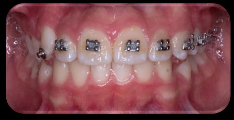 Vicente Emmanuel Silva Rangel-13