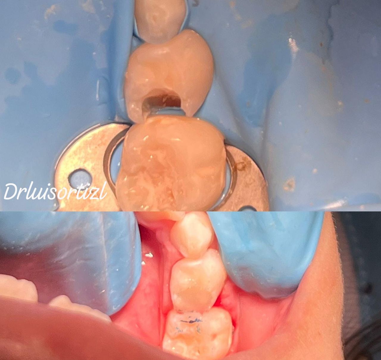 Luis Ángel Ortiz López-29