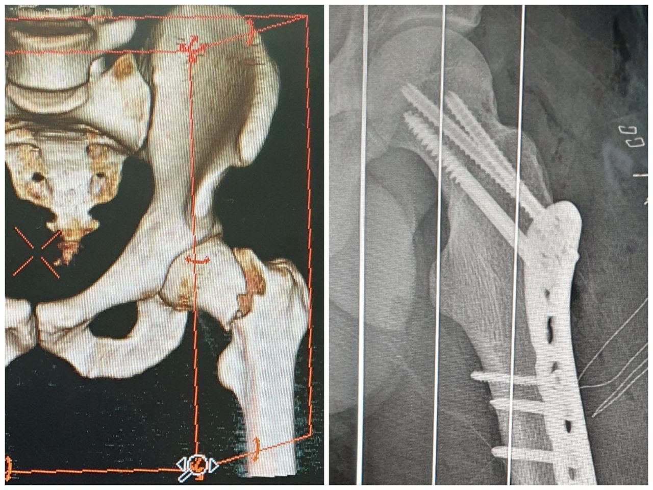 Gabriel De Leon Ochoa Lara-0