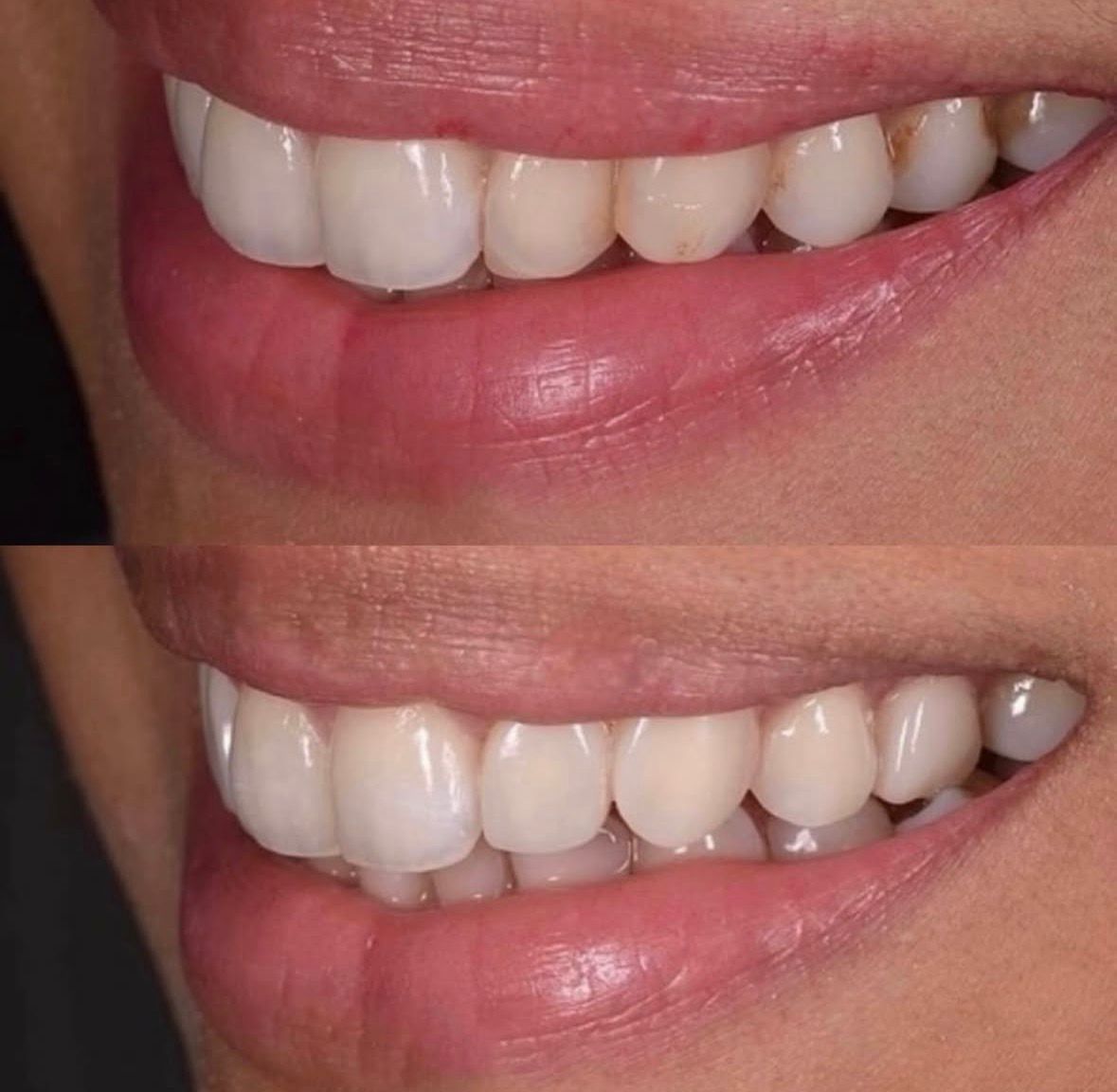 Juan Manuel Mares-15