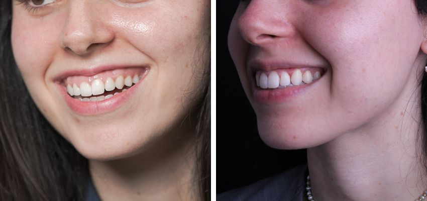 Federico Suastegui Carmona-5