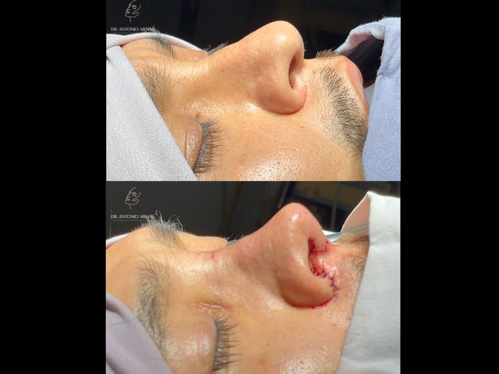 Juan Antonio González Armas-3