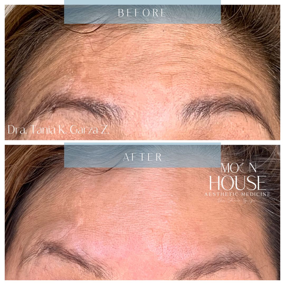 Tania Karine Garza Zepeda-0