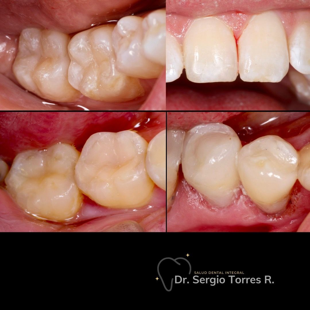 Sergio Torres Rivera-6