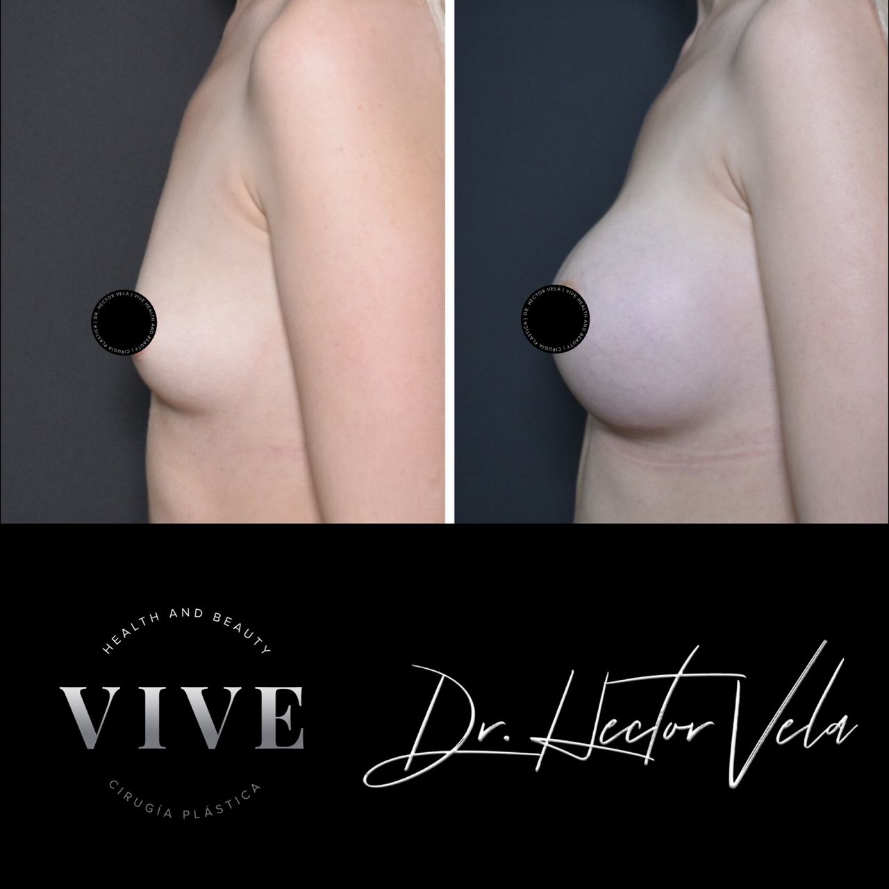 Héctor Eduardo Vela Cardona-155