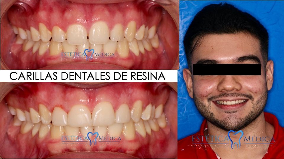 Bielmy Veronica Jonapa Peña-9