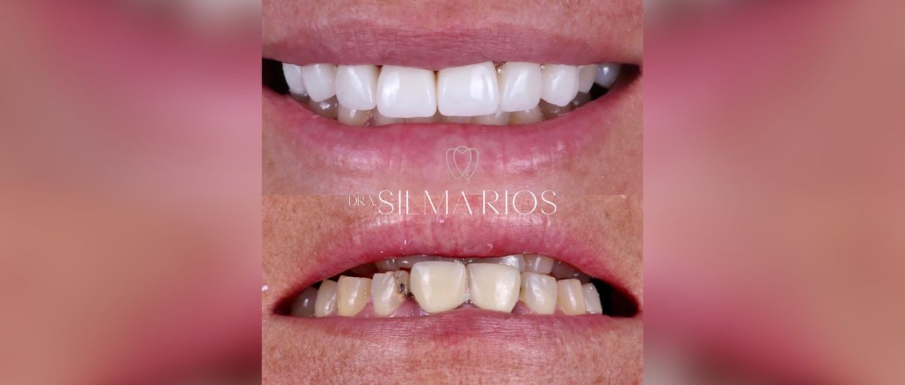 Silma Chavez Rios-8
