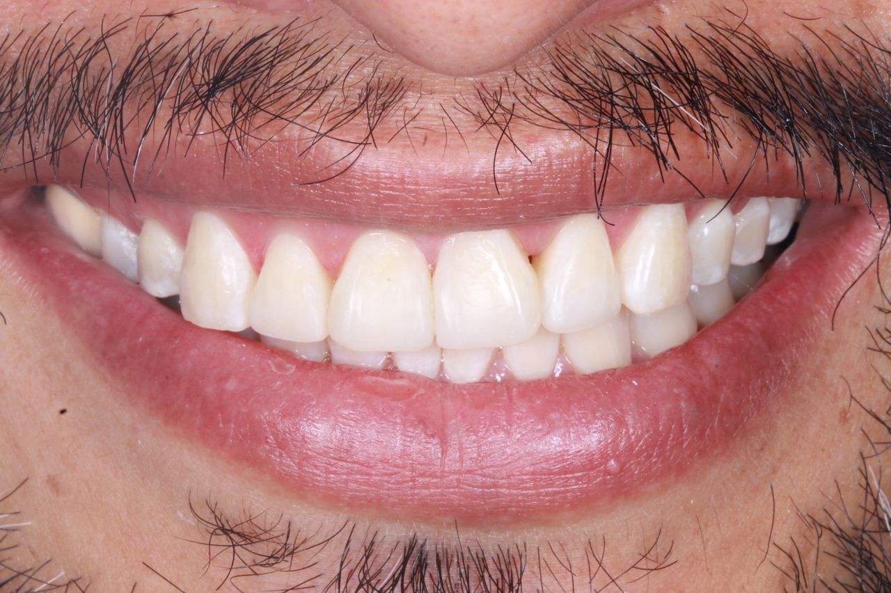 Heidi Mendoza Malagón-24