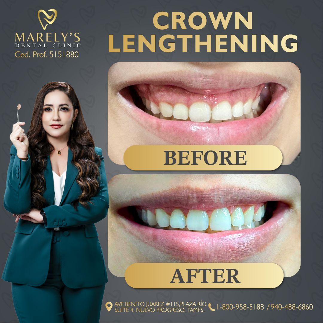 Luz Marely García Alvarez-1