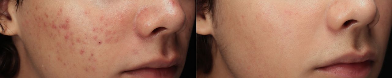 Lauro Francisco Varela Coronado-3