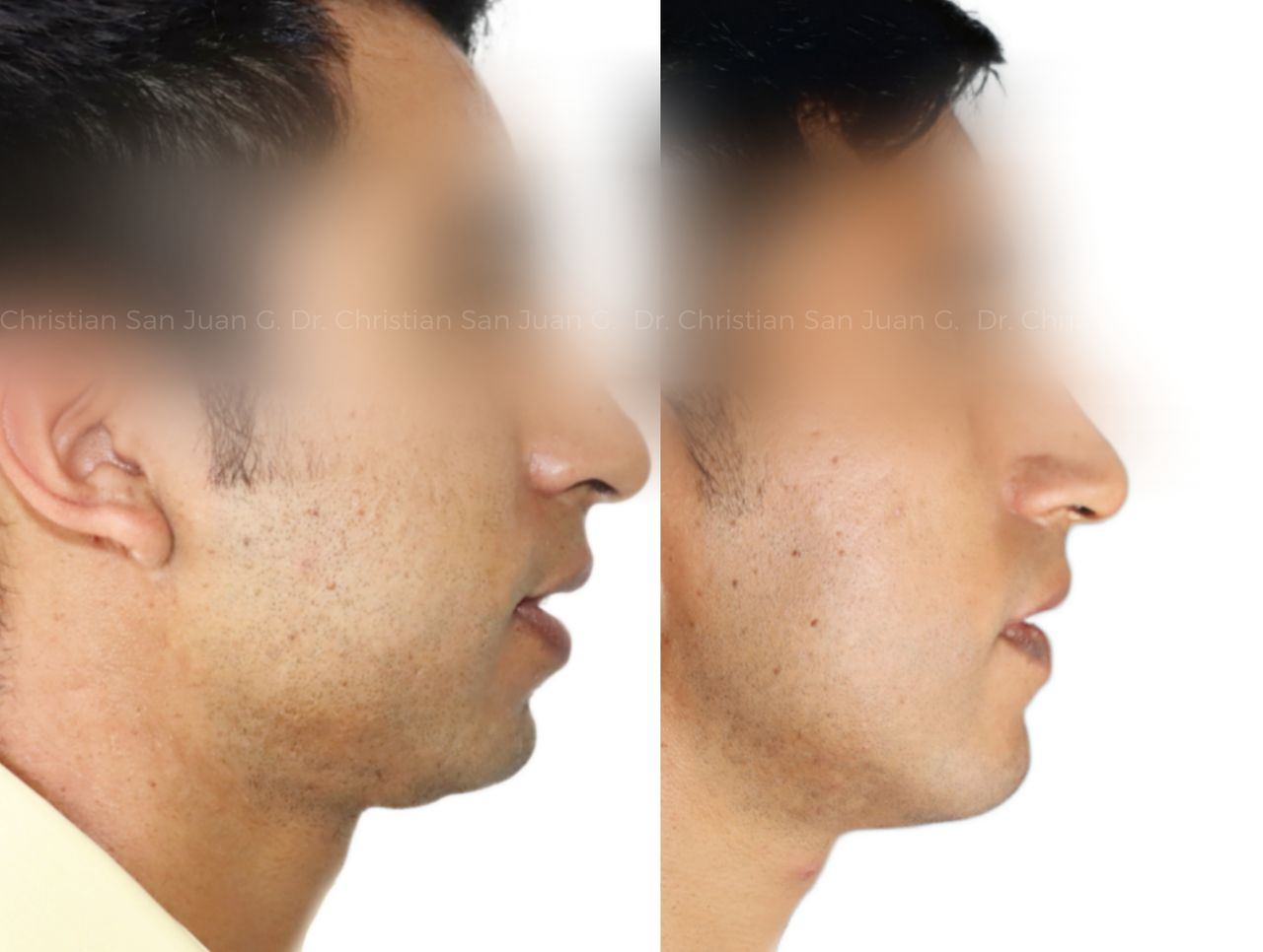 Christian San Juan González-8