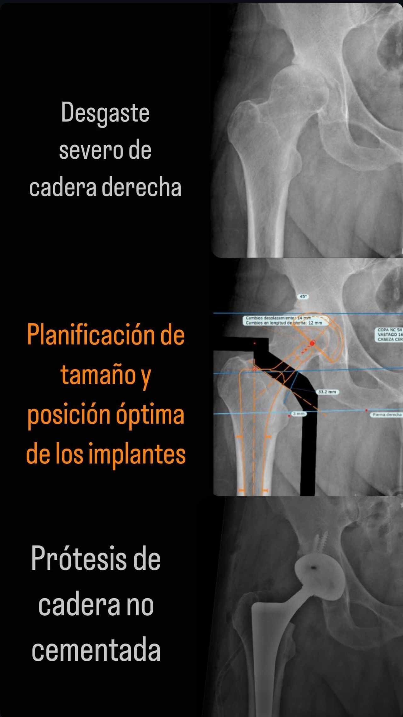 Vicente Carrasco García-17