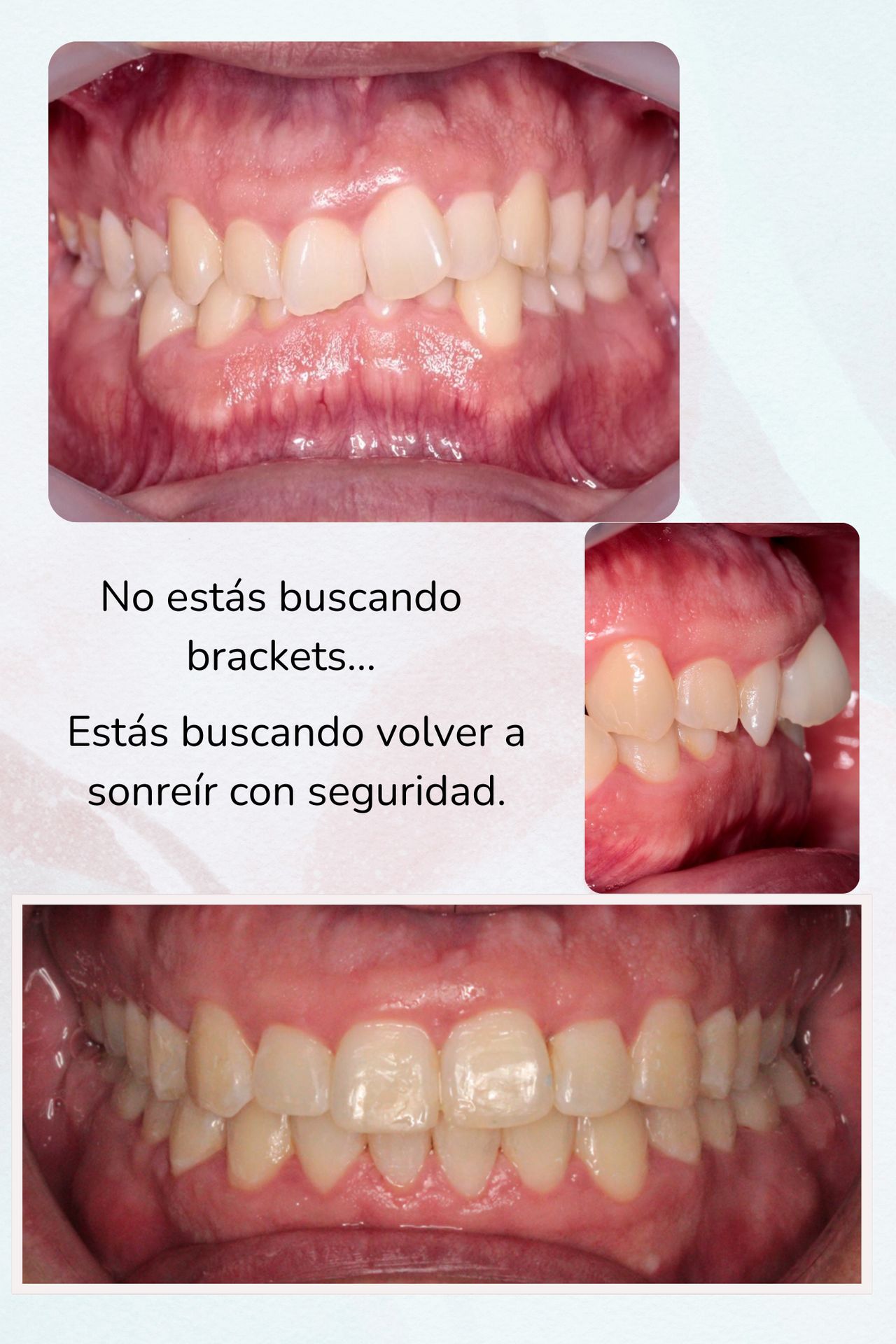 Nora Gabriela Loranca Moscosa-3