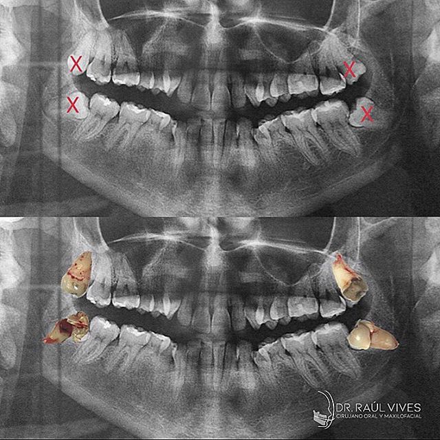 Raúl José Vives Serrano-8