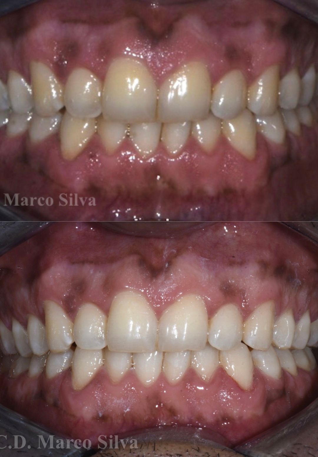 Marco Antonio Silva-13