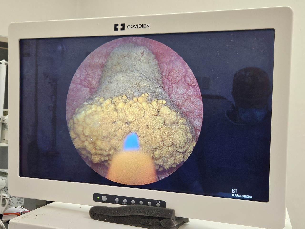 Michel Bastarrachea Solis-5